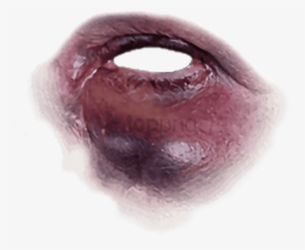 Black Eye Freetoedit - Bruise Black Eye Transparent, HD Png Download, Free Download
