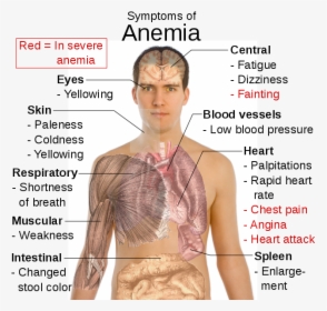 Symptoms Of Anaemia - Symptoms Of Anemia, HD Png Download, Free Download