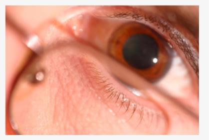 Pupil Dilation - Close-up, HD Png Download, Free Download