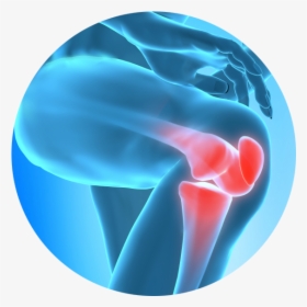 Chronic Joint Pain Slowing You Down Learn How Regenerative - Knee Pain Png, Transparent Png, Free Download