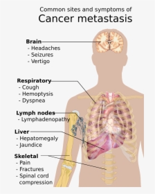 Common Sites And Symptoms Of Cancer Metastasis, HD Png Download, Free Download