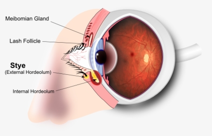 Eye - Eye Stye Diagram, HD Png Download, Free Download