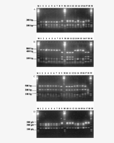 Pcr Rflp Of The 16s 23s Rdna Spacer Regions Digested - Architecture, HD Png Download, Free Download