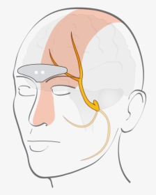 Cefaly - External Trigeminal Nerve Stimulation, HD Png Download, Free Download