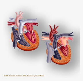 Coronary-arteries - Two Human Heart, HD Png Download, Free Download