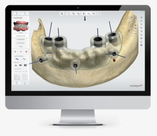 3shape Software, HD Png Download, Free Download