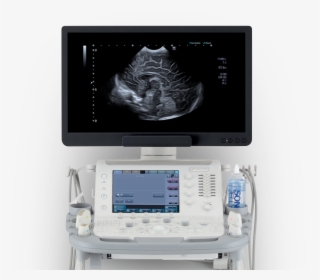 Ultrasonography, HD Png Download, Free Download