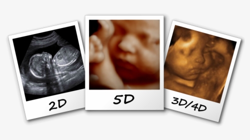 3d/4d/5d Ultrasound Fayetteville Nc Comparison Image - 3d 4d 5d Ultrasound, HD Png Download, Free Download