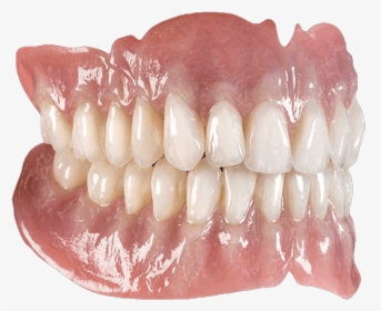 Implant Supported Dentures Are The Best Form Of False - Gingiva Ceramic, HD Png Download, Free Download