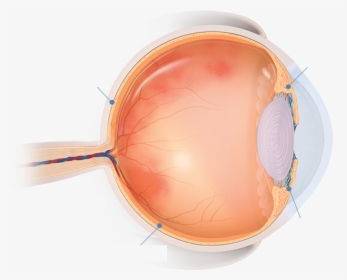 Areas Of The Eye Affected By Uveitis - Circle, HD Png Download, Free Download