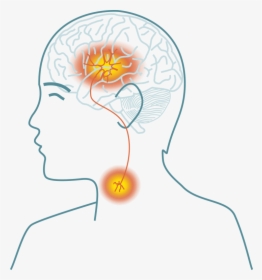 Stroke Disease Png, Transparent Png, Free Download