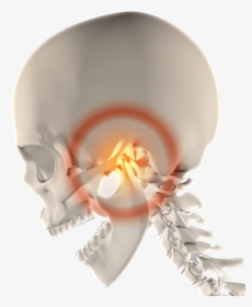 Tmj Therapy Tmj Pain Jaw Pain Florence Sc Tmj Dentist - Jaw Cramp, HD Png Download, Free Download