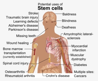 Stem Cell Treatments - Can Stem Cells Be Used, HD Png Download, Free Download