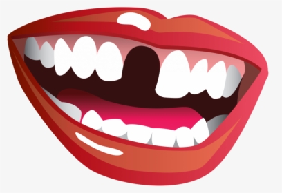 Mouth Smile Png Image - Smile With A Missing Tooth, Transparent Png, Free Download