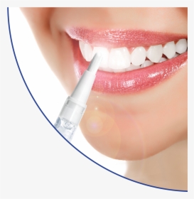 White Blitz Teeth Whitening Teeth Whitening For Spas/salons - Teeth Whitening Png, Transparent Png, Free Download