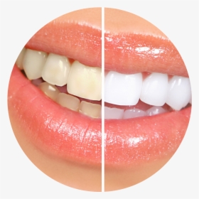 Teeth Smile Png, Transparent Png, Free Download
