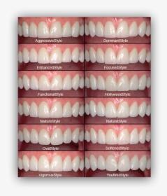 Different Styles Of Veneers, HD Png Download, Free Download