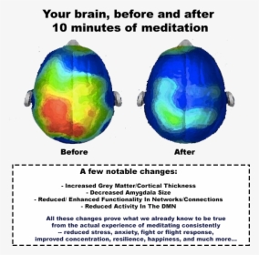 A Few Notable Changes - Brain Before And After Drinking, HD Png Download, Free Download