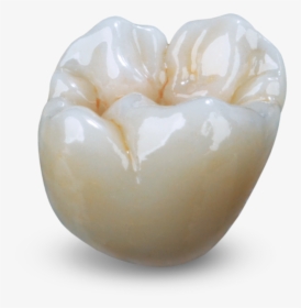 Monolithic Zirconia Crown, HD Png Download, Free Download