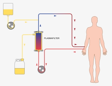 Plasma Exchange Plasmapheresis, HD Png Download, Free Download