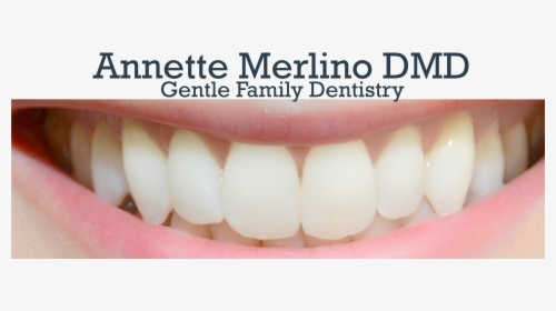 Annette Merlino, Dmd Logo - Jaw, HD Png Download, Free Download