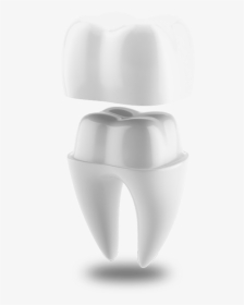 Dental Crown Model San Jose, Ca - Sculpture, HD Png Download, Free Download