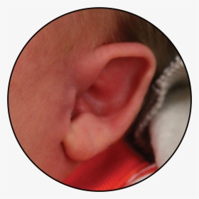 Baby Born With Folded Down Ear - Have A Perfect Straight Narroe Ears, HD Png Download, Free Download