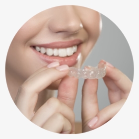 Invisalign-woman 196892522 - Clear Aligners, HD Png Download, Free Download