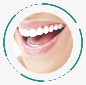 Digital Smile Design - Promocion Limpieza Dental Queretaro, HD Png Download, Free Download