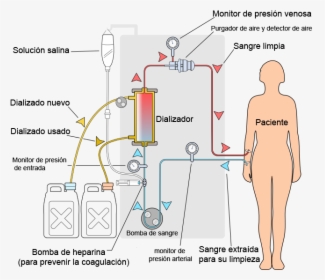 File - Hemodiálisis - Dialysis Pressure, HD Png Download, Free Download