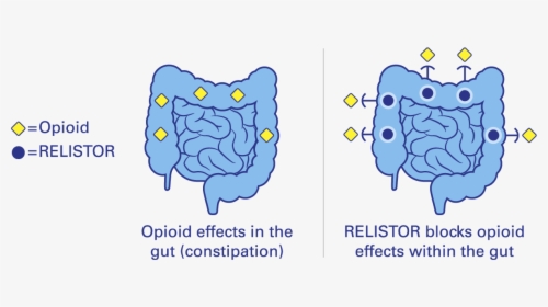 Relistor Prevents Opioid Effects, HD Png Download, Free Download