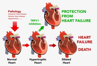 Png Transparent Stock Disease Clipart Heart Damage - Unlabeled Heart Diagram, Png Download, Free Download
