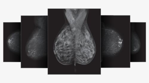 Densitas Breast Scan - Radiology, HD Png Download, Free Download