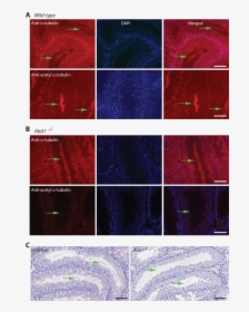 Acetylated Tubulin Drosophila Testis, HD Png Download, Free Download