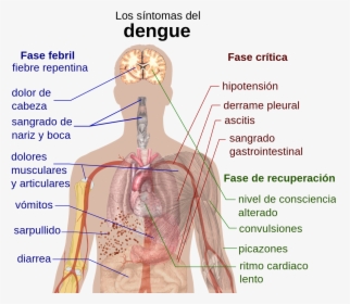 Symptoms Of Dengue Mosquito Bite, HD Png Download, Free Download