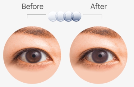 Oasys Transition Eyediagram - Acuvue Oasys With Transitions, HD Png Download, Free Download