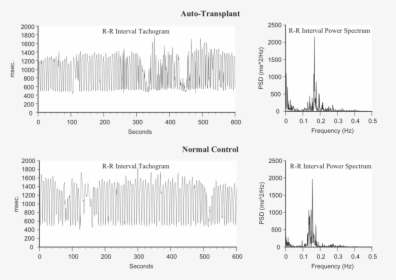 Heart Rhythms Generated By A Transplanted Heart At - Poster, HD Png Download, Free Download