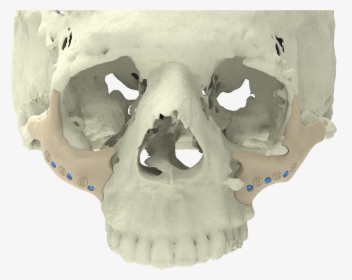 Xilloc Medical B - Skull, HD Png Download, Free Download