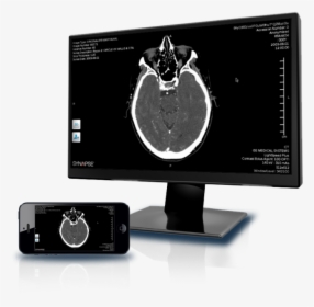 Synapse Mobility - Computer Monitor, HD Png Download, Free Download