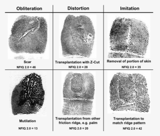 Fingerprint Scar, HD Png Download, Free Download