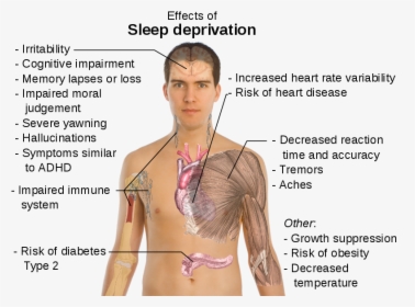 Sleep Deprevation, HD Png Download, Free Download