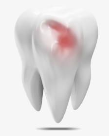 Damaged Tooth Model - Fang, HD Png Download, Free Download