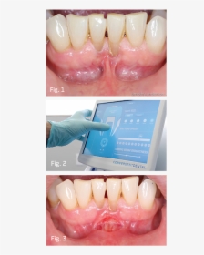 Dentaltown Magazine - Tongue, HD Png Download, Free Download