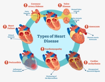 Types Of Heart Disease Graphic - Heart Disease Diagram, HD Png Download, Free Download