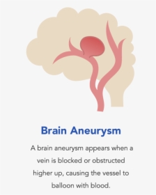 Brain Aneurysm, What Is A Brain Aneurysm - Causes Brain Aneurysm, HD Png Download, Free Download