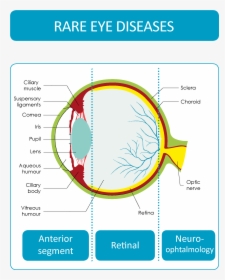 Rare Eye Diseases - Diseases Of Anterior Segment Of The Eye, HD Png Download, Free Download