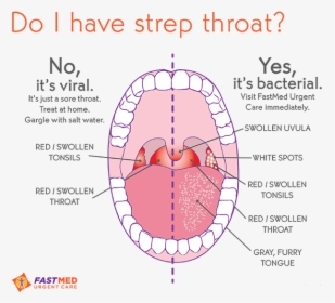 Strep Throat Symptoms, HD Png Download, Free Download