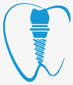 Dente Implante Png, Transparent Png, Free Download