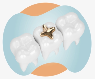 Three Teeth And One Molar With A Gold Dental Inlay - Icing, HD Png Download, Free Download