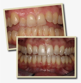 Transparent Teeth Smile Png - Jaw, Png Download, Free Download